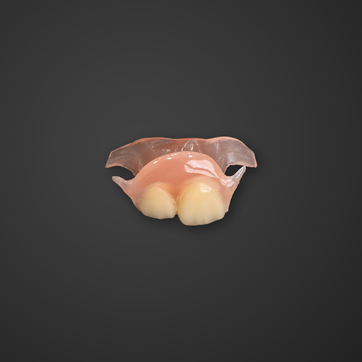 ノンクラスプデンチャー(部分入れ歯)