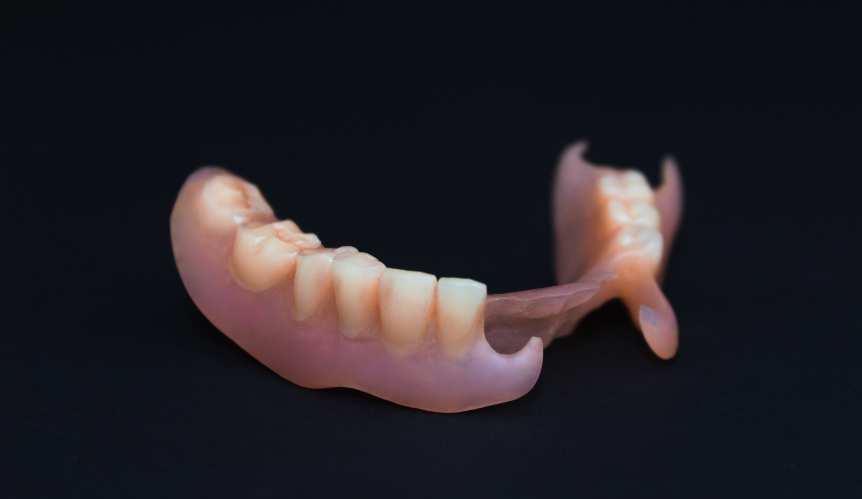 ノンクラスプデンチャー