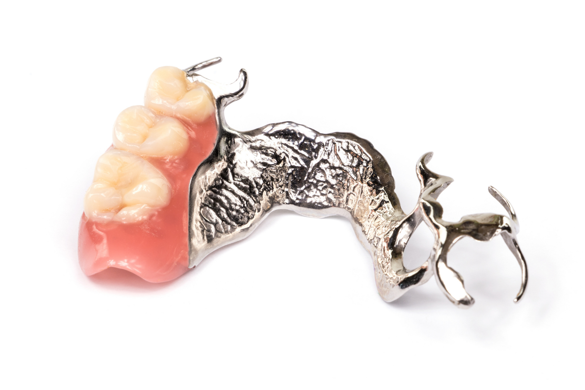 金属床デンチャー