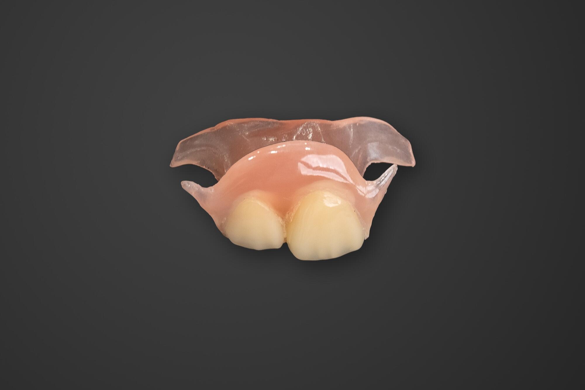 ノンクラスプデンチャー