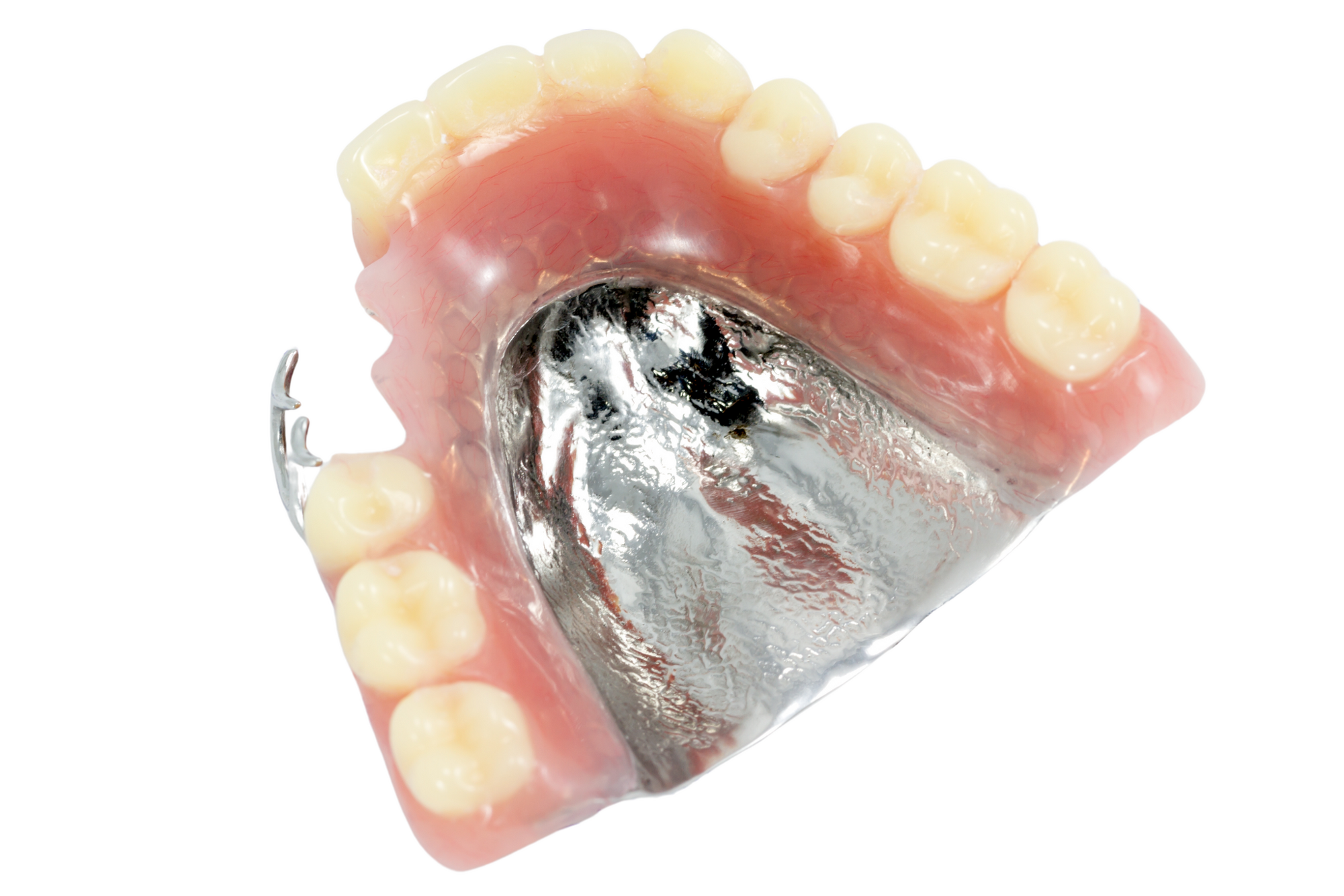 金属床デンチャー