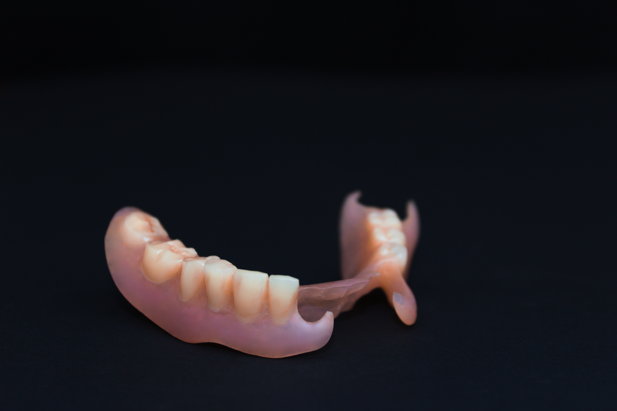 ノンクラスプデンチャー